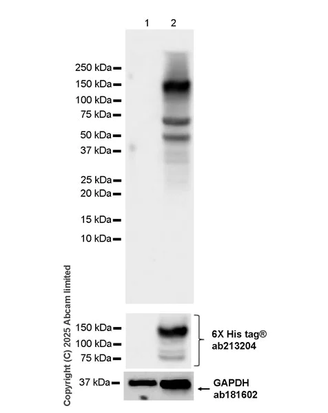 Western blot - Anti-BOTOX antibody [EPR28067-534] (AB324596)