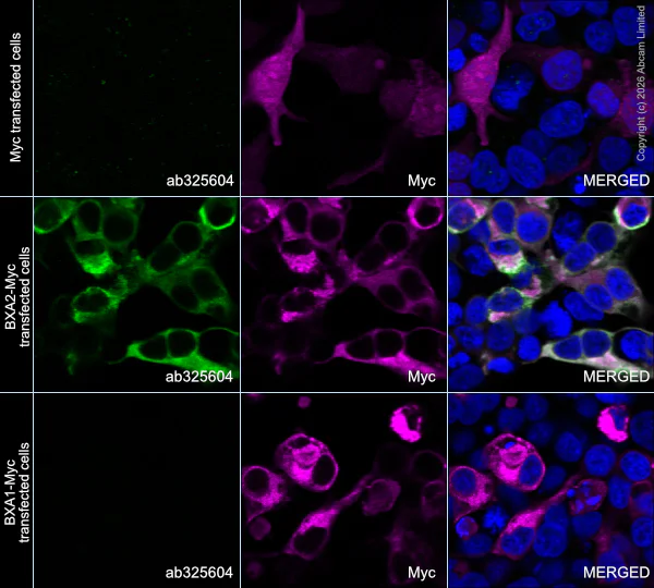 Immunocytochemistry/ Immunofluorescence - Anti-Botulinum neurotoxin type A2/BOTOX antibody [EPR28762-552] (AB325604)