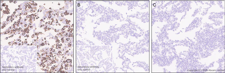 Immunohistochemistry (Formalin/PFA-fixed paraffin-embedded sections) - Anti-Botulinum neurotoxin type A2/BOTOX antibody [EPR28762-552] (AB325604)