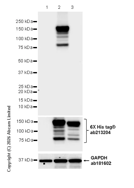 Western blot - Anti-Botulinum neurotoxin type A2/BOTOX antibody [EPR28762-552] (AB325604)