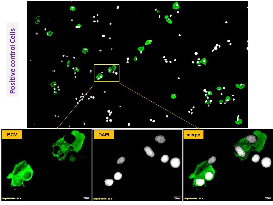 Immunocytochemistry/ Immunofluorescence - Anti-Bovine Coronavirus [2B8] (AB315148), expandable thumbnail