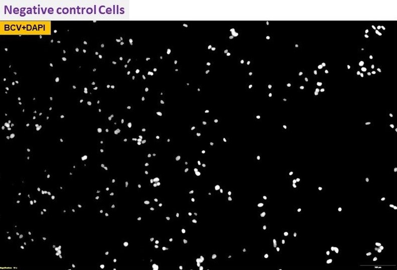 Immunocytochemistry/ Immunofluorescence - Anti-Bovine Coronavirus [2B8] (AB315148), expandable thumbnail