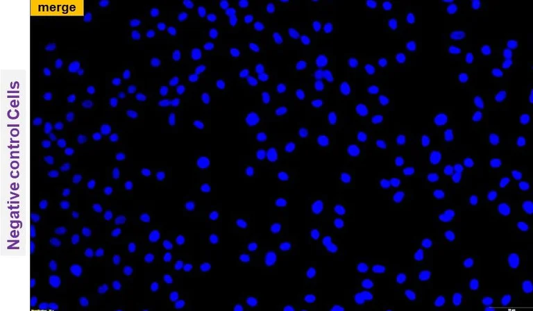 Immunocytochemistry/ Immunofluorescence - Anti-Bovine Coronavirus [9G10] (AB315149)