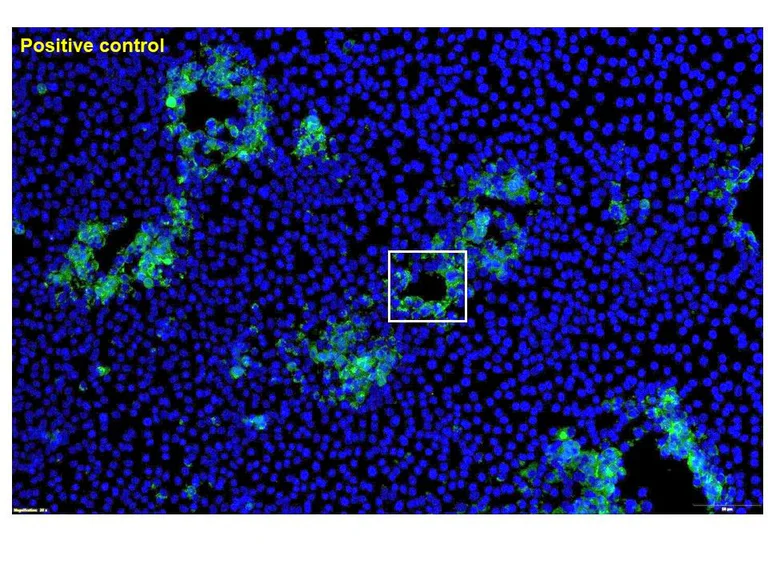 Immunocytochemistry/ Immunofluorescence - Anti-Bovine Herpesvirus 1- gE antibody [1B5] (AB325992)