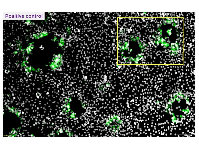 Immunocytochemistry/ Immunofluorescence - Anti-Bovine Herpesvirus 1- gE antibody [2D5] (AB325993)