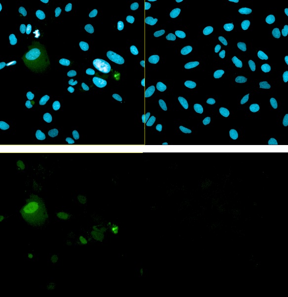 Immunocytochemistry/ Immunofluorescence - Anti-Bovine Papilloma Virus E2 antibody [5H4] (AB1072)