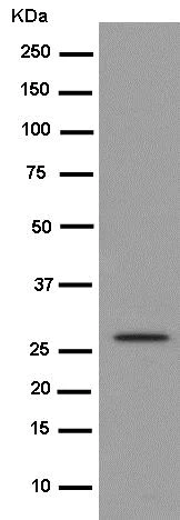 Western blot - Anti-BPGM antibody [EPR15127] (AB186434)