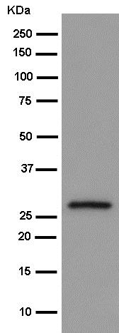 Western blot - Anti-BPGM antibody [EPR15127] (AB186434), expandable thumbnail