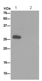 Immunoprecipitation - Anti-BPGM antibody [EPR15128] - BSA and Azide free (AB250893)