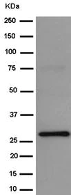 Western blot - Anti-BPGM antibody [EPR15128] - BSA and Azide free (AB250893)