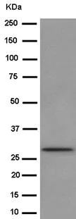 Western blot - Anti-BPGM antibody [EPR15128] - BSA and Azide free (AB250893)