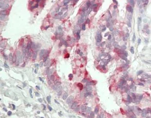 Immunohistochemistry (Formalin/PFA-fixed paraffin-embedded sections) - Anti-BPIFB1 antibody [2A5] (AB219098)