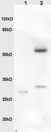 Western blot - Anti-BPIFB1 antibody (AB203350), expandable thumbnail