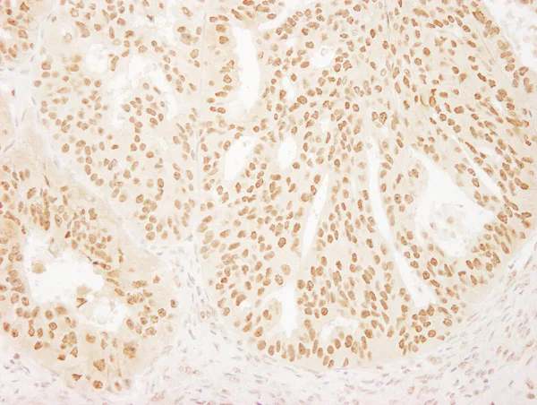 Immunohistochemistry (Formalin/PFA-fixed paraffin-embedded sections) - Anti-BPTF / FALZ antibody (AB72036)