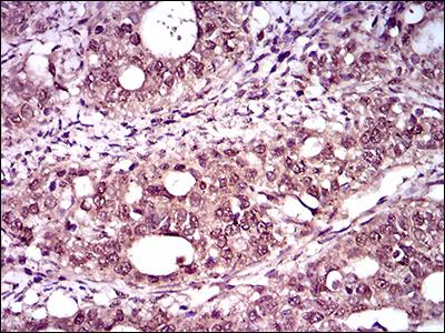 Immunohistochemistry (Formalin/PFA-fixed paraffin-embedded sections) - Anti-Brachyury / Bry antibody [1H9A2] (AB140661)