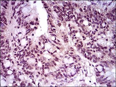 Immunohistochemistry (Formalin/PFA-fixed paraffin-embedded sections) - Anti-Brachyury / Bry antibody [1H9A2] (AB140661)