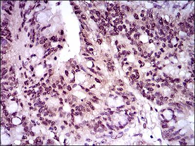 Immunohistochemistry (Formalin/PFA-fixed paraffin-embedded sections) - Anti-Brachyury / Bry antibody [1H9A2] (AB140661)