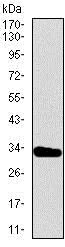 Western blot - Anti-Brachyury / Bry antibody [1H9A2] (AB140661)