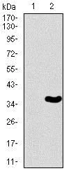 Western blot - Anti-Brachyury / Bry antibody [1H9A2] (AB140661)