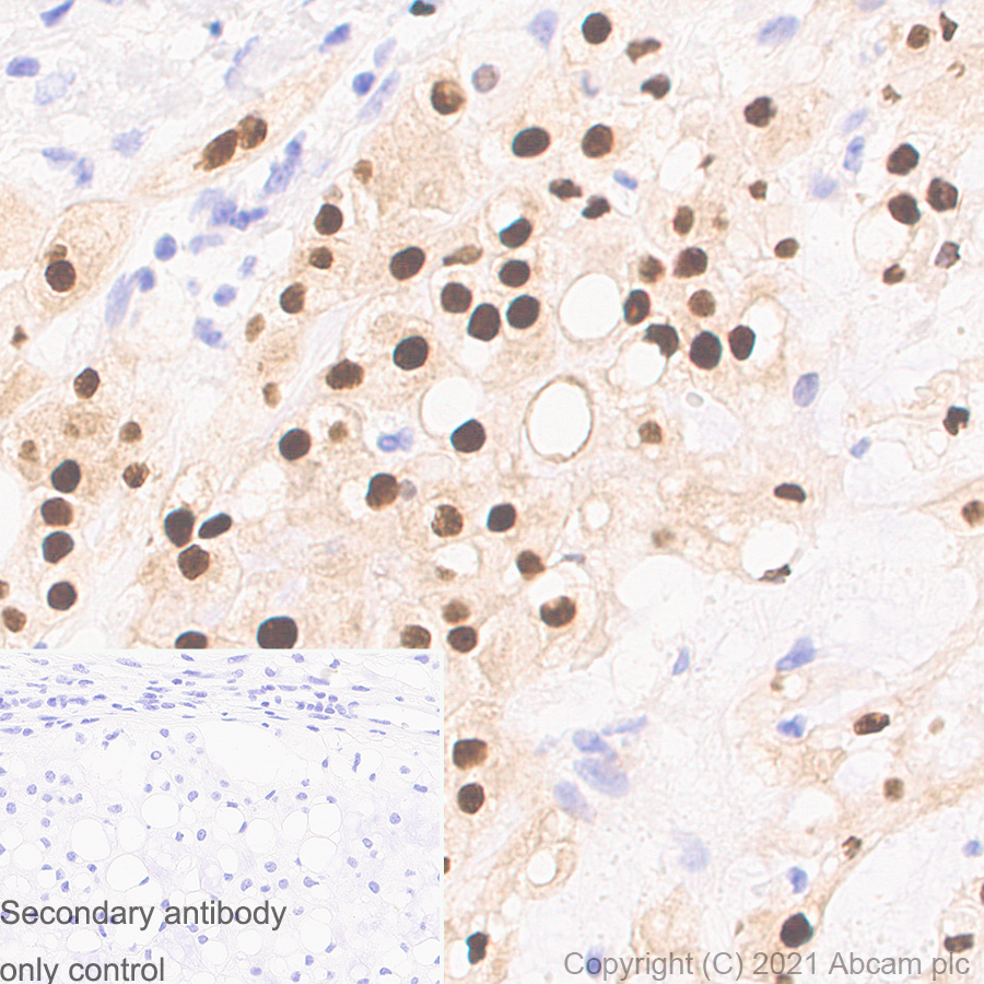 Immunohistochemistry (Formalin/PFA-fixed paraffin-embedded sections) - Anti-Brachyury / Bry antibody [54] (AB259260), expandable thumbnail