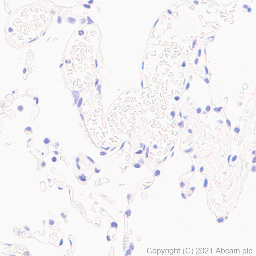 Immunohistochemistry (Formalin/PFA-fixed paraffin-embedded sections) - Anti-Brachyury / Bry antibody [54] (AB259260), expandable thumbnail