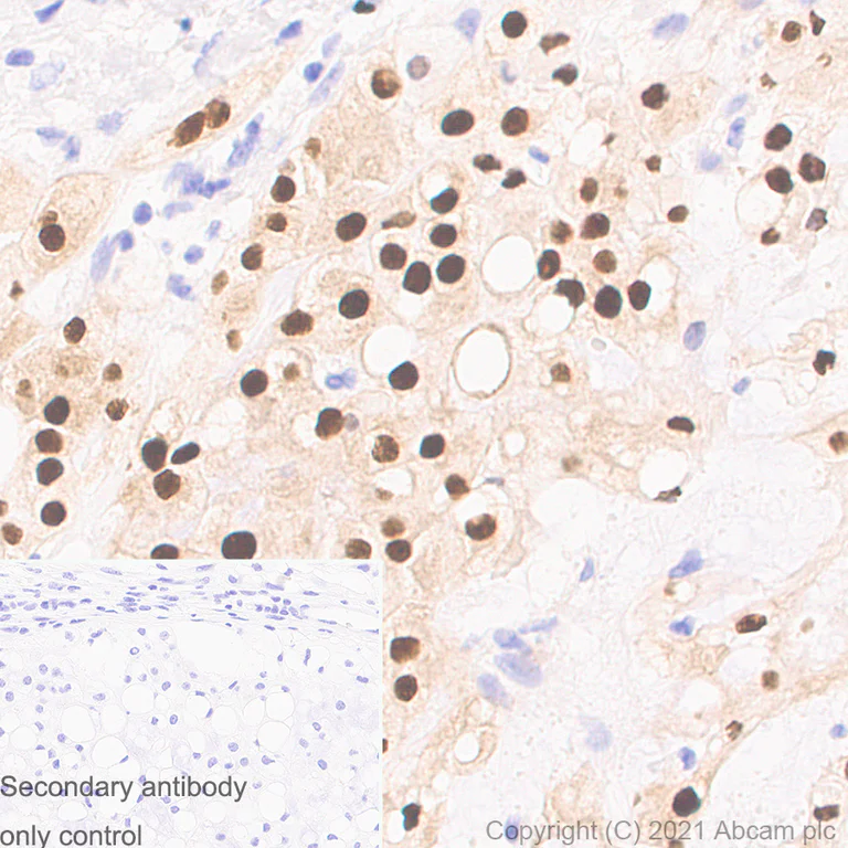 Immunohistochemistry (Formalin/PFA-fixed paraffin-embedded sections) - Anti-Brachyury / Bry antibody [54] - BSA and Azide free (AB259261)