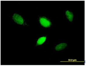 Immunocytochemistry/ Immunofluorescence - Anti-Brachyury / Bry antibody (AB167337)