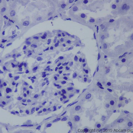 Immunohistochemistry (Formalin/PFA-fixed paraffin-embedded sections) - Anti-Brachyury / Bry antibody [EPR18113] (AB209665)