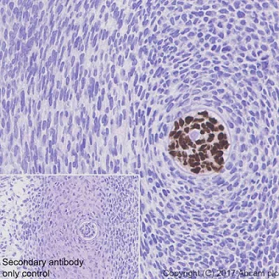 Anti-Brachyury / Bry antibody [EPR18113] (ab209665) | Abcam