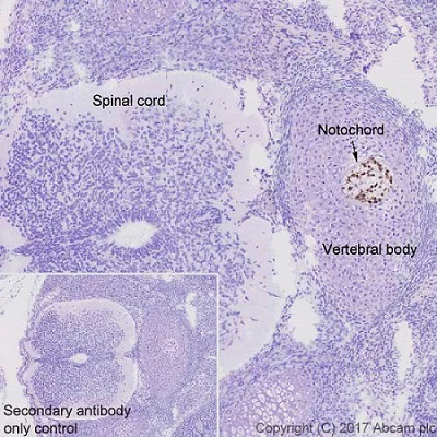 Immunohistochemistry (Formalin/PFA-fixed paraffin-embedded sections) - Anti-Brachyury / Bry antibody [EPR18113] (AB209665)