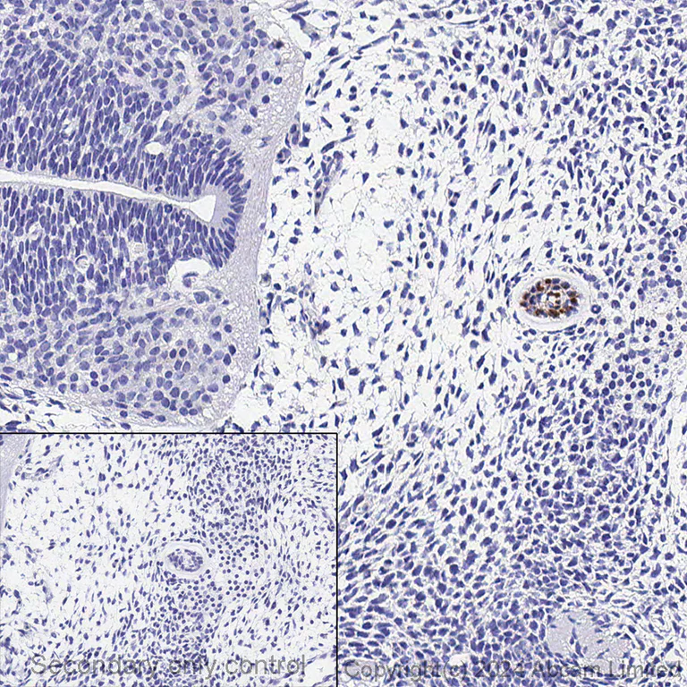 Immunohistochemistry (Formalin/PFA-fixed paraffin-embedded sections) - Anti-Brachyury / Bry antibody [EPR18113] (AB209665)