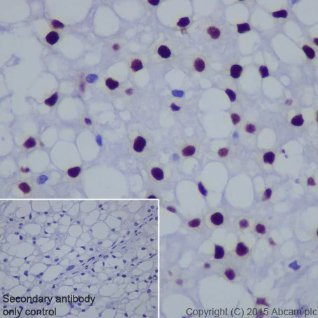 Immunohistochemistry (Formalin/PFA-fixed paraffin-embedded sections) - Anti-Brachyury / Bry antibody [EPR18113] - BSA and Azide free (AB236023)
