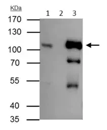Immunoprecipitation - Anti-BRAF antibody (AB137367)