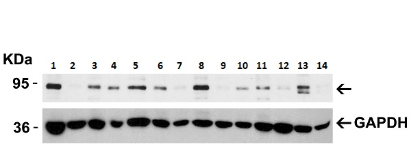 Western blot - Anti-BRAF antibody (AB254565), expandable thumbnail