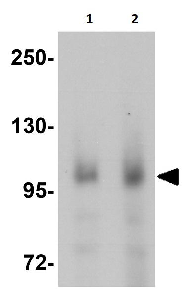 Western blot - Anti-BRAF antibody (AB254565), expandable thumbnail