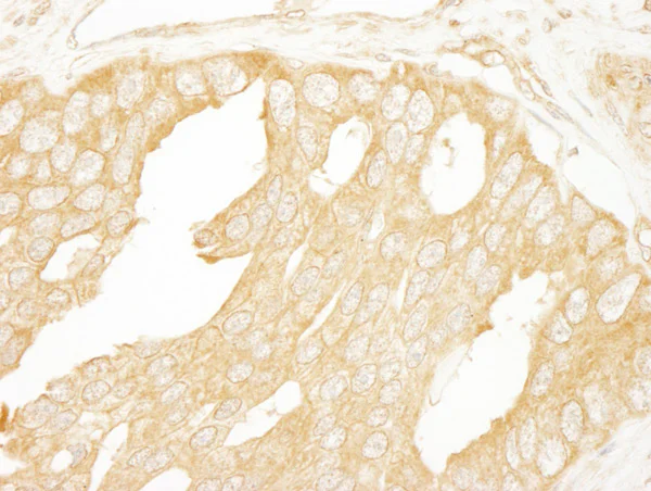 Immunohistochemistry (Formalin/PFA-fixed paraffin-embedded sections) - Anti-BRAF antibody (AB85972)