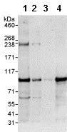 Western blot - Anti-BRAF antibody (AB85972)