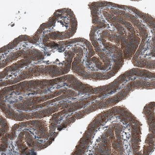 Immunohistochemistry (Formalin/PFA-fixed paraffin-embedded sections) - Anti-BRAF antibody [CL4004] (AB220032)