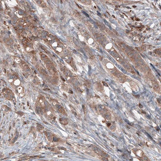 Immunohistochemistry (Formalin/PFA-fixed paraffin-embedded sections) - Anti-BRAF antibody [CL4004] (AB220032)