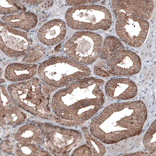 Immunohistochemistry (Formalin/PFA-fixed paraffin-embedded sections) - Anti-BRAF antibody [CL4004] (AB220032)