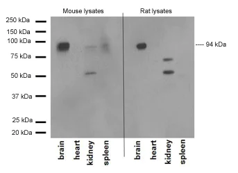 Western blot - Anti-BRAF antibody [EP152Y] (AB33899)