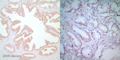 Immunohistochemistry (Formalin/PFA-fixed paraffin-embedded sections) - Anti-BRAF antibody [EP152Y] - BSA and Azide free (AB189351), expandable thumbnail