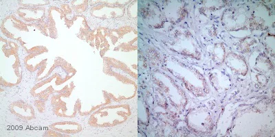Immunohistochemistry (Formalin/PFA-fixed paraffin-embedded sections) - Anti-BRAF antibody [EP152Y] - BSA and Azide free (AB189351)