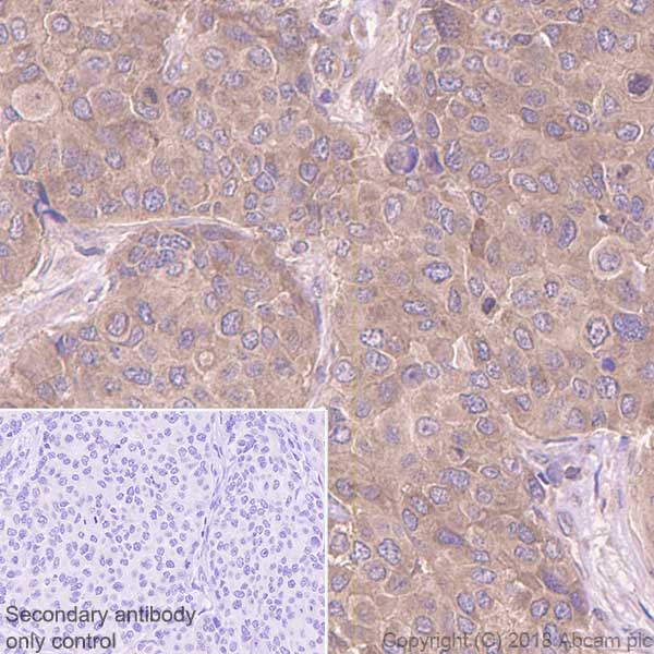 Immunohistochemistry (Formalin/PFA-fixed paraffin-embedded sections) - Anti-BRAF antibody [EP152Y] - BSA and Azide free (AB189351), expandable thumbnail