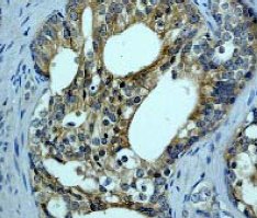 Immunohistochemistry (Formalin/PFA-fixed paraffin-embedded sections) - Anti-BRAF antibody [EP152Y] - BSA and Azide free (ab189351), expandable thumbnail