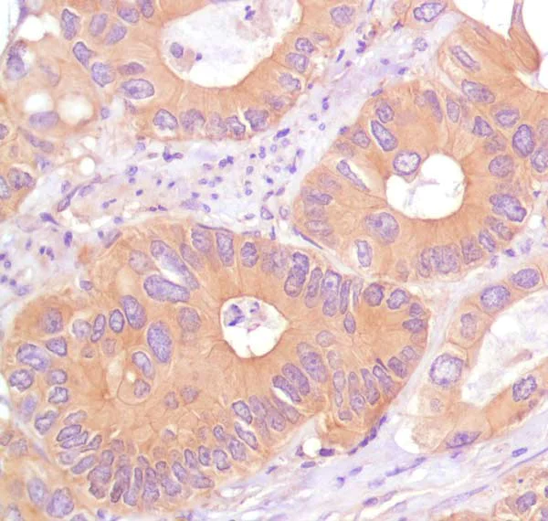 Immunohistochemistry (Formalin/PFA-fixed paraffin-embedded sections) - Anti-BRAF antibody [pBR1] (AB183337)