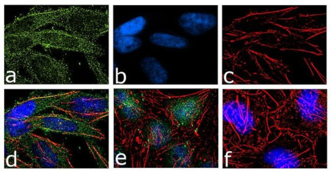 Anti-BRAF antibody [RP23040159] (ab313460) | Abcam