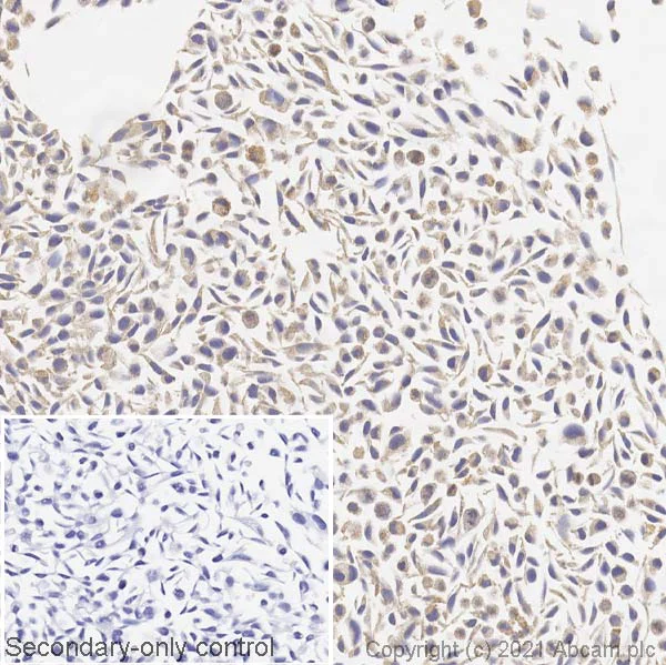 Immunohistochemistry (Formalin/PFA-fixed paraffin-embedded sections) - Anti-BRAF (mutated V600E) antibody [VE1] (AB228461)