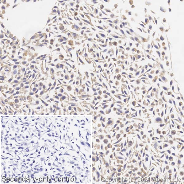 Immunohistochemistry (Formalin/PFA-fixed paraffin-embedded sections) - Anti-BRAF (mutated V600E) antibody [VE1] - BSA and Azide free (AB324341), expandable thumbnail