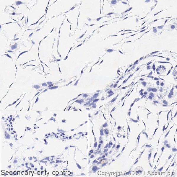 Immunohistochemistry (Formalin/PFA-fixed paraffin-embedded sections) - Anti-BRAF (mutated V600E) antibody [VE1] - BSA and Azide free (AB324341), expandable thumbnail